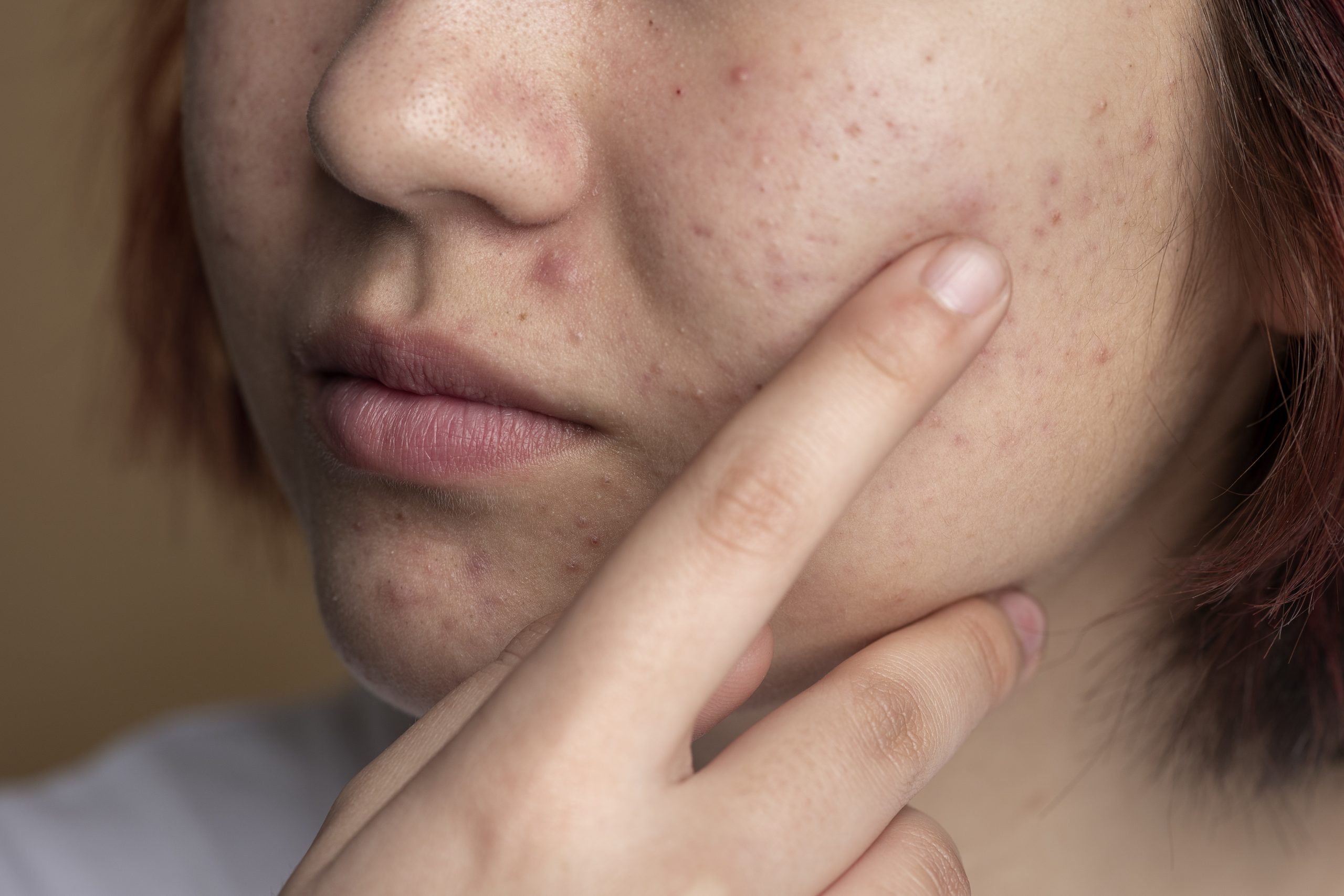 close-up-skin-pores-face-care-routine